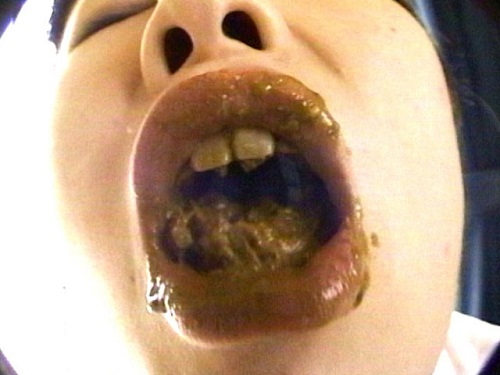 エログロドキュメント ウンゲロミミズ ウンゲロミミズ2 妹便 妹便2サンプル2